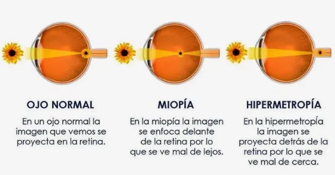 Ojo humano